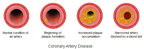 dealing-with-chronic-diseases-archives-healthy-lifestyle